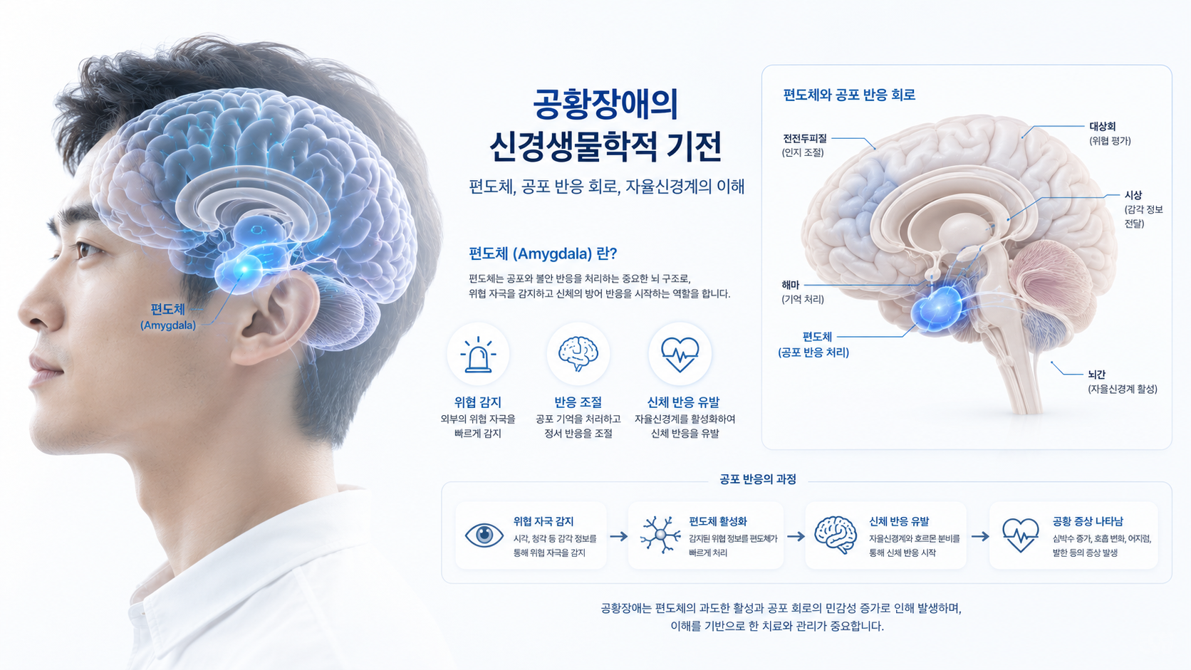 공황장애 신경기전에서 편도체와 불안 반응의 관계를 설명하는 뇌 구조 이미지
